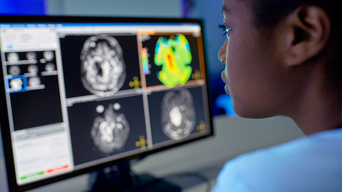 Applications IRM en neurologie