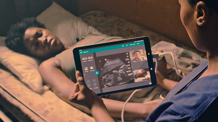 T&eacute;l&eacute;-&eacute;chographie int&eacute;gr&eacute;e avec Lumify, bas&eacute;e sur Reacts &ndash; Vid&eacute;o